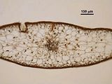 Sezione trasversale della porzione distale del tallo con nervatura mediana e cripta pilifera.